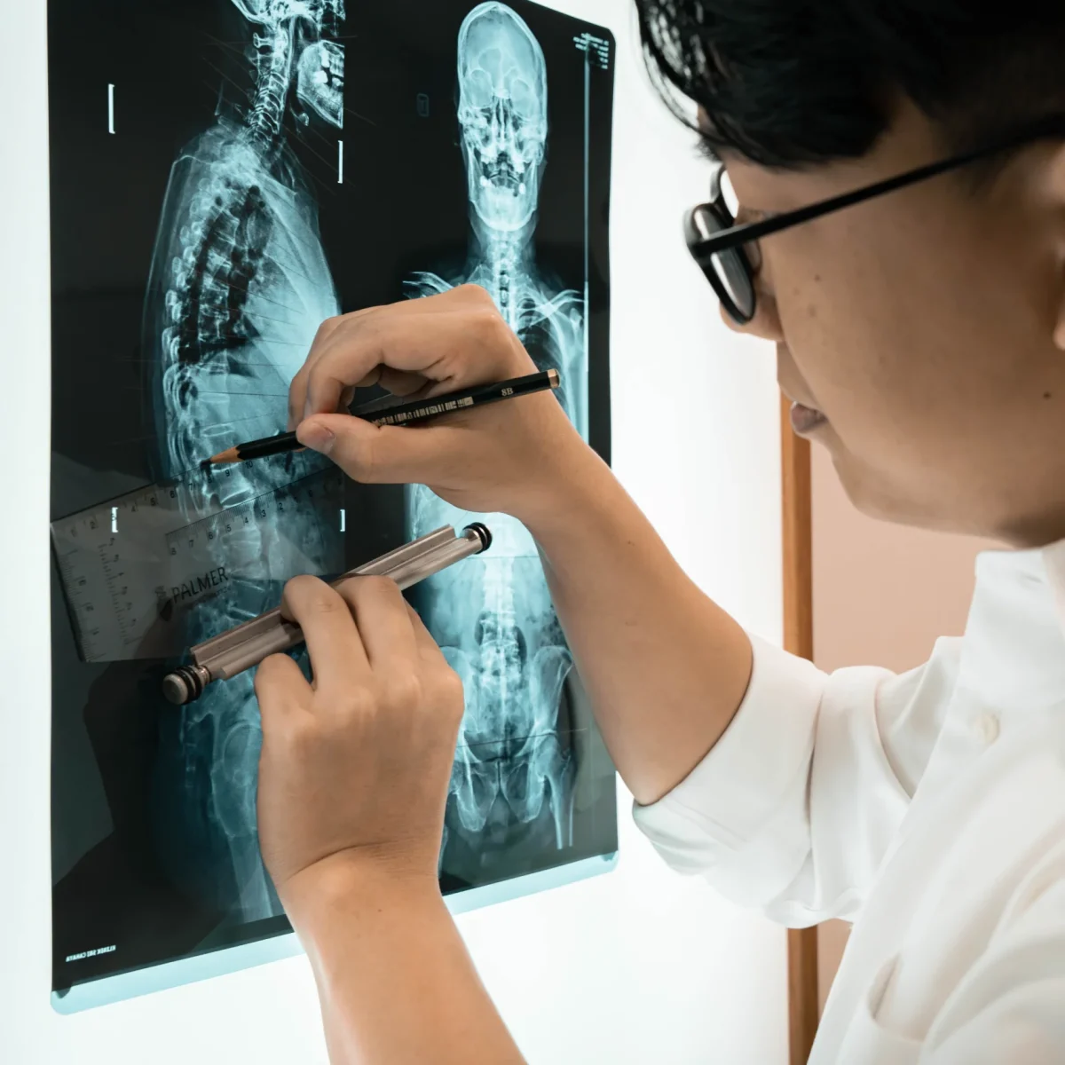 Gonstead-Chiropractor-Analysing-X-ray